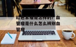 红色素瘤是怎样的？血管瘤是什么怎么辨别血管瘤