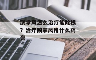 鹅掌风怎么治疗能除根？治疗鹅掌风用什么药膏